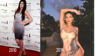 Fans Still Suspect Kylie Jenner Has Had Breast Plastic Surgery