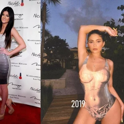 Best plastic surgeon of Kardashian Klan Kylie Jenner 2010 versus KJ in 2019