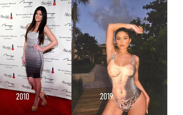 Best plastic surgeon of Kardashian Klan Kylie Jenner 2010 versus KJ in 2019