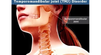 How can Temporomandibular Joints (TMJ) Cause Sore Throat