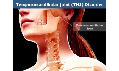 How can Temporomandibular Joints TMJ Cause Sore Throat