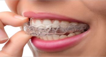 Mouth Guard Day 2020: Types of mouthguards with pros and cons