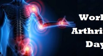 World Arthritis Day 2020: Arthritis types, symptoms, causes, risk factors and treatment