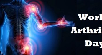 World Arthritis Day 2020: Arthritis types, symptoms, causes, risk factors and treatment