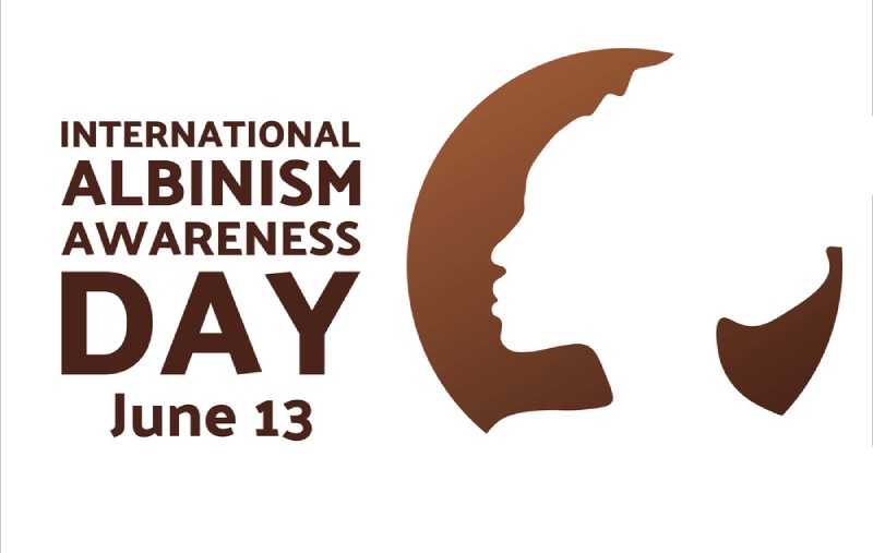 International Albinism Awareness Day