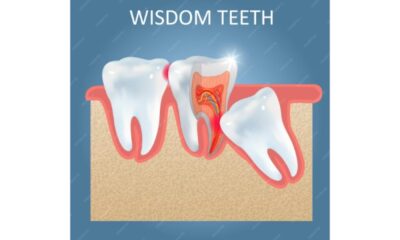 Know About Wisdom Tooth from Langley Dentist