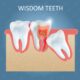 Know About Wisdom Tooth from Langley Dentist