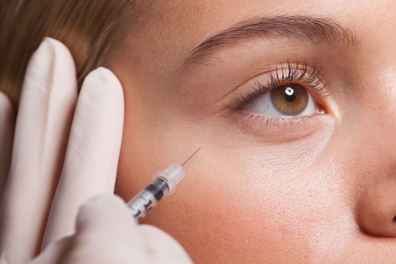 The Science Behind Botox How It Erases Wrinkles and Fine Lines