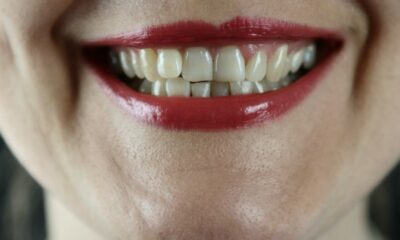 Teeth Whitening Importance and the Best Place to Go