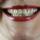 Teeth Whitening Importance and the Best Place to Go