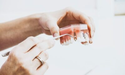 Dental Implants Kelowna Advantages, Procedure, and Post Procedure Care