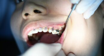 7 Things To Check Before You Enter Best Dental Clinic in Cloverdale