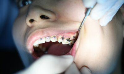 7 Things To Check Before You Enter Best Dental Clinic in Cloverdale
