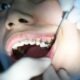 7 Things To Check Before You Enter Best Dental Clinic in Cloverdale