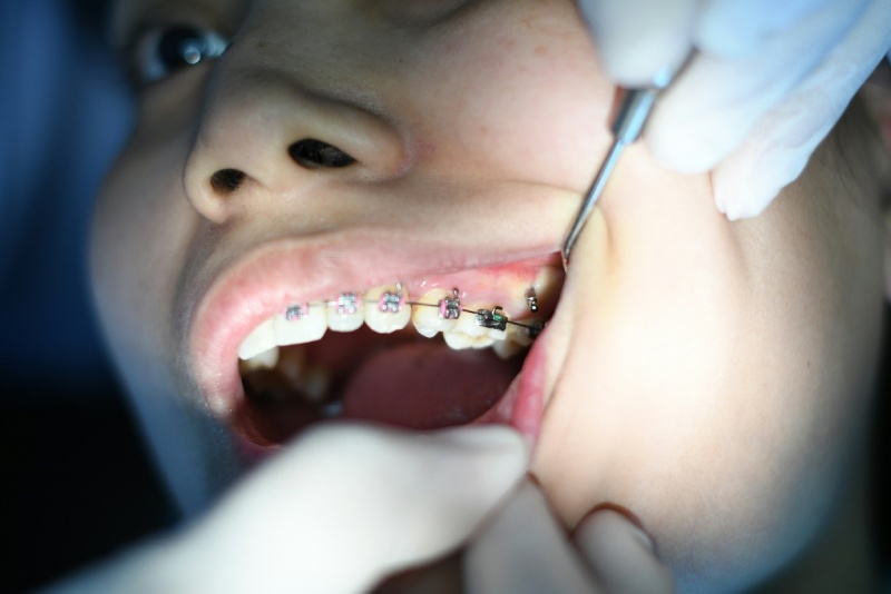 7 Things To Check Before You Enter Best Dental Clinic in Cloverdale