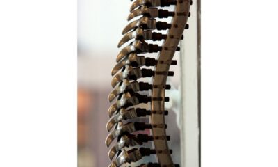Rethinking Spine Surgery Training to Meet the Challenges of the Future Insights from Brent Felix