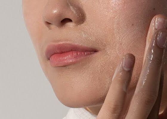 Which Skincare Routine Works Best For Acne Prone Skin