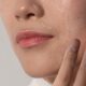 Which Skincare Routine Works Best For Acne Prone Skin
